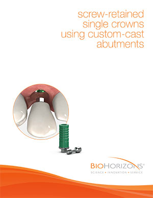 Screw-retained single crowns using custom-cast abutments
