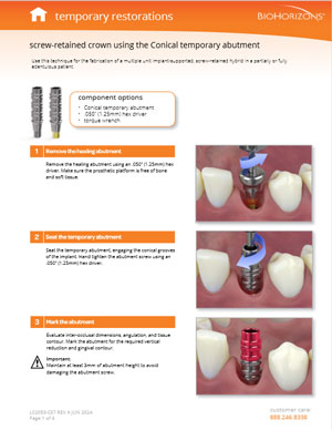 Screw-retained crown using the PEEK temporary cylinder abutment