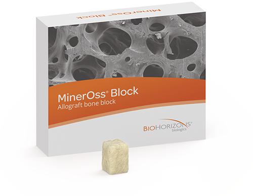 MinerOss Block Allograft