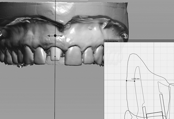 Vulcan Custom Dental services