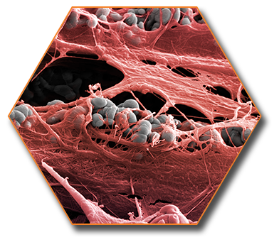 Laser-Lok microchannels