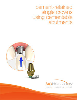Cement-retained single crowns using cementable abutments