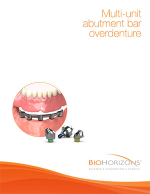 Multi-unit abutment bar overdenture