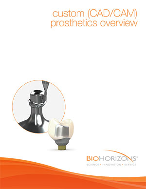 Custom (CAD/CAM) prosthetics overview