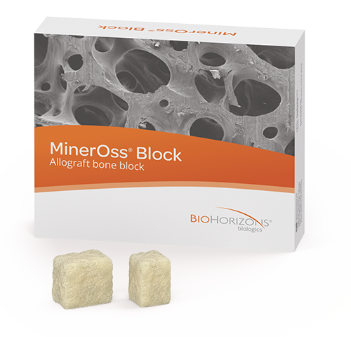 MinerOss Block