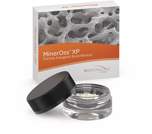 MinerOss-XP-particulate