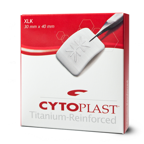 Cytoplast Titanium-Reinforced Membranes