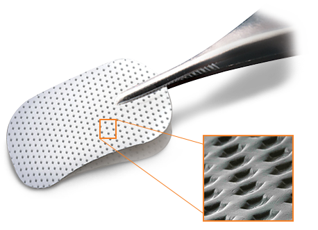 Cytoplast Titanium-Reinforced d-PTFE Membranes