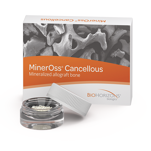 MinerOss Cancellous