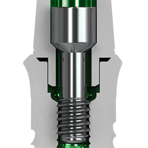 Cross Section